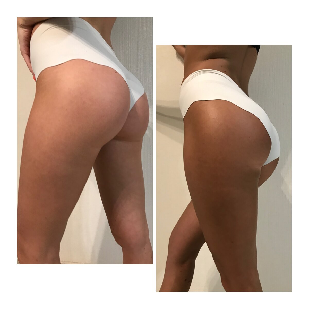 Результат до/после