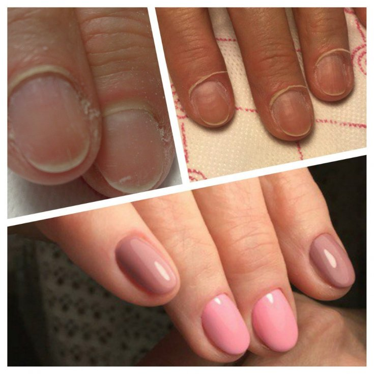 Наращивание ногтей на формы пошагово. Пошаговое наращивание ногтей. Полигель для моделирования ногтей. Наращивание гелем пошагово. Маникюр этапы выполнения.