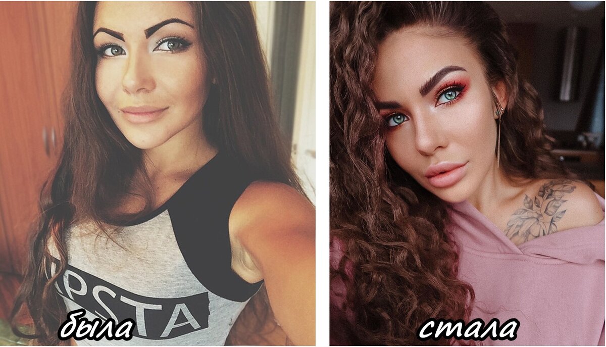 Стужук софия до и после пластики фото