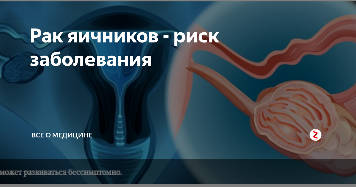Рак яичников - риск заболевания | Все о медицине | Дзен