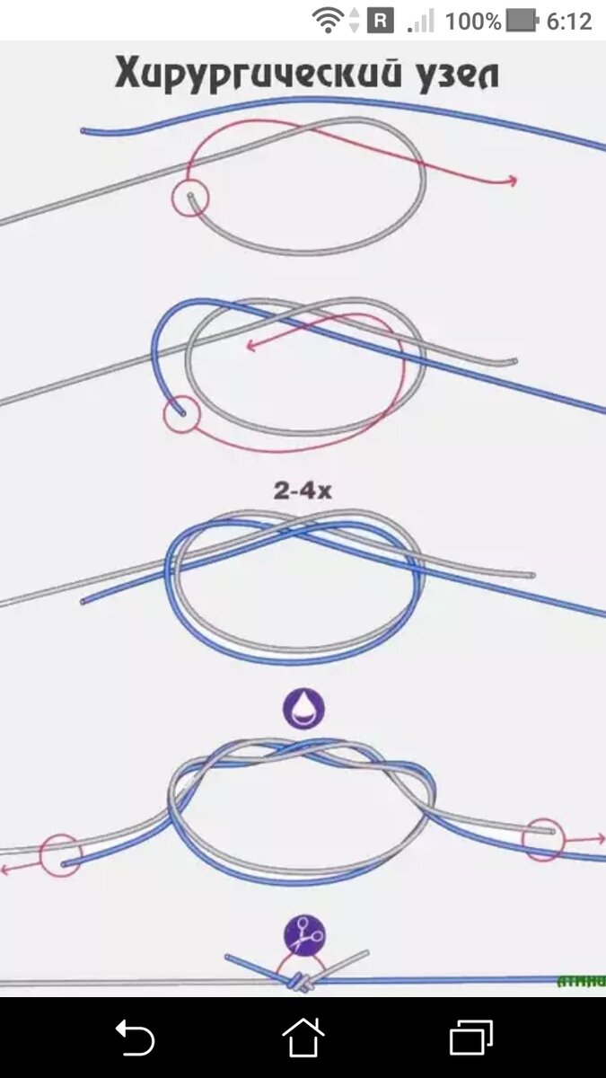 фото рисунок хирургический узел