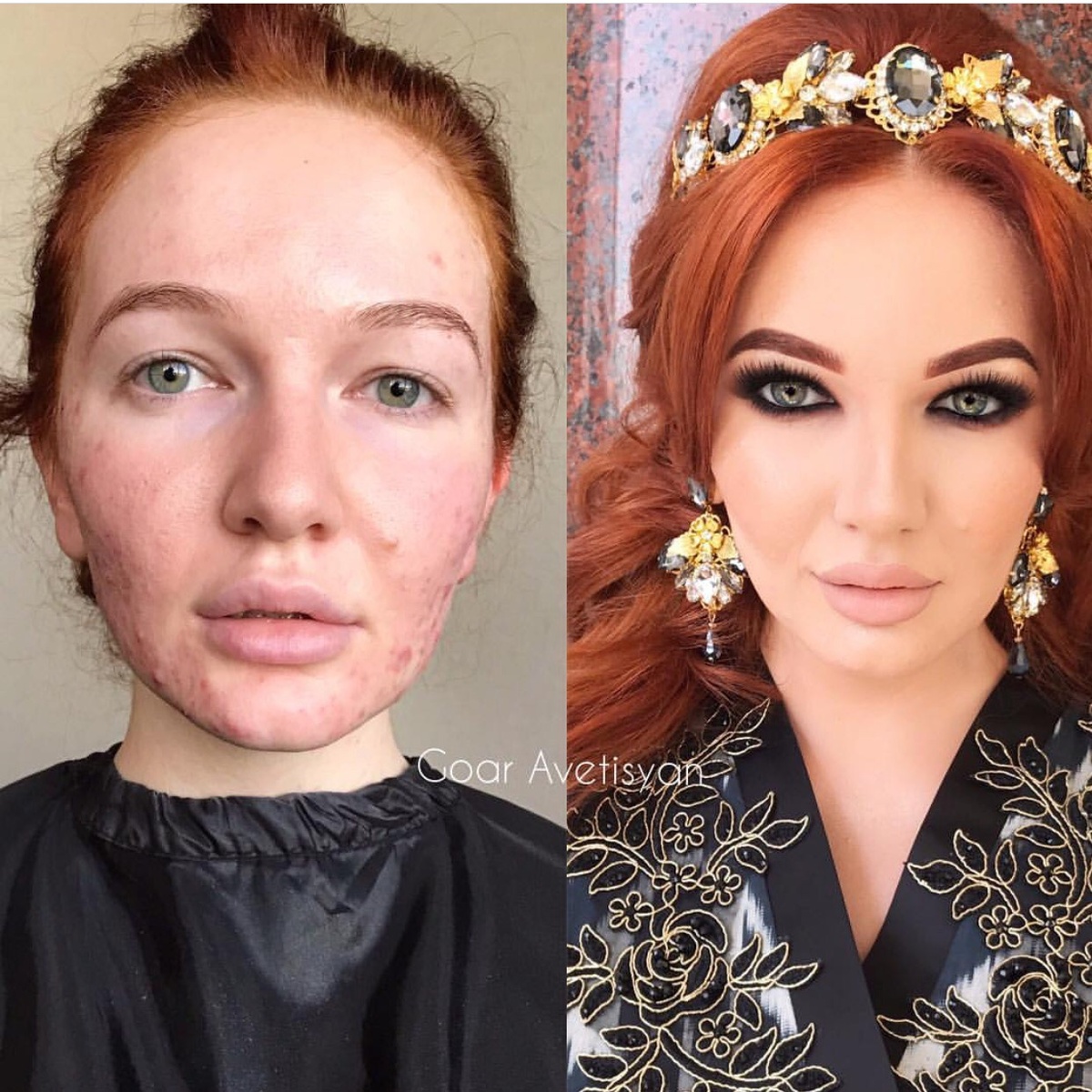 Фото взято их открытого источника.