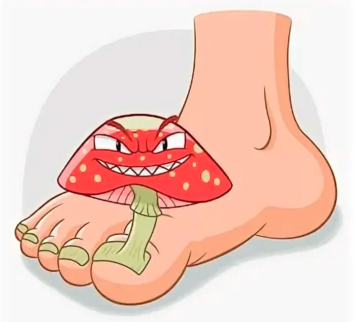 Грибок стопы