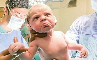 Роды – это всегда трудно и чаще всего больно, иногда очень. Для женщины. А ведь в этом процессе всегда участвуют двое!