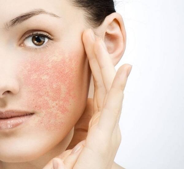 Фото взято из открытого источника