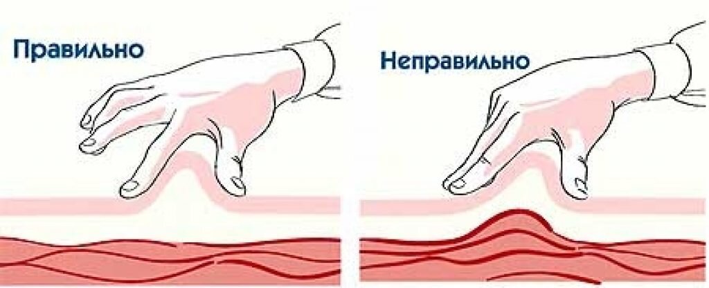 Как ставить подкожно в живот. Введение инсулина шприцом подкожно. Техника введения гепарина в живот подкожно. Алгоритм техники введения инсулина подкожно. Гепарин подкожно в живот алгоритм.