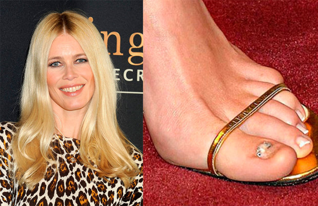 Фото взято в качестве примера к публикации из Яндекс картинок 