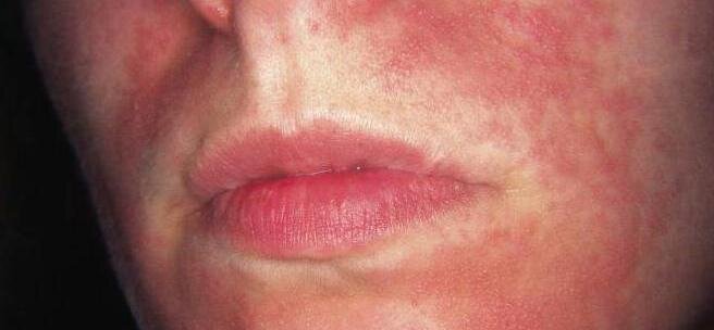 Взято из яндекс картинок. Статья из внешнего источника.