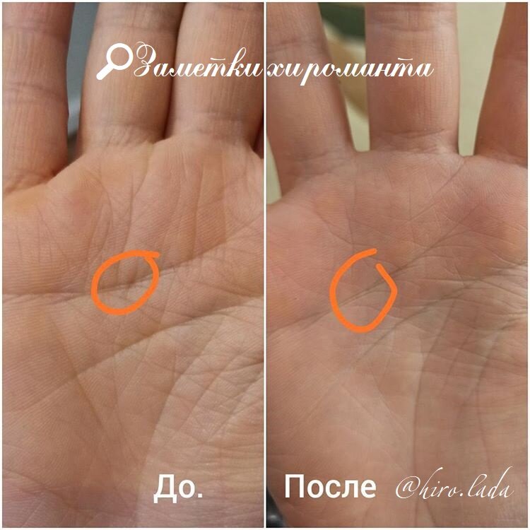 фотография с выделенной точкой (слева), исчезнувшей после (справа)