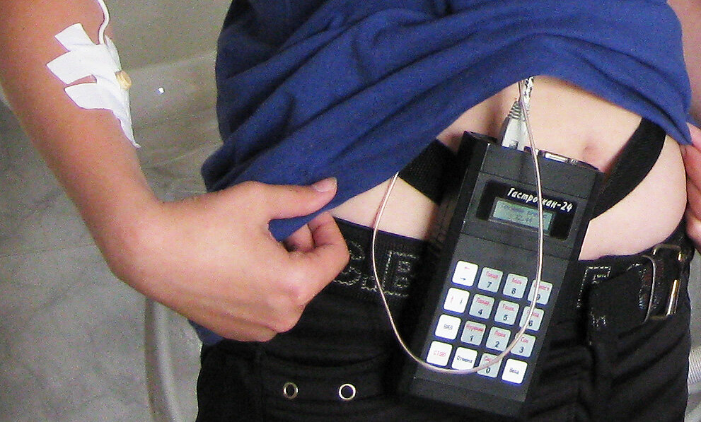 С таким приемником и зондом необходимо ходить при суточном мониторировании кислотности