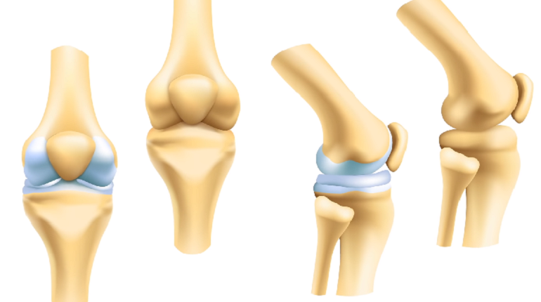 Действие гидрогеля на суставы. Фото: Youtube