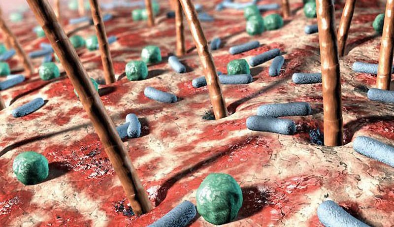 Чем больше микроорганизмов на поверхности тела, тем более явно ощущается запах. 