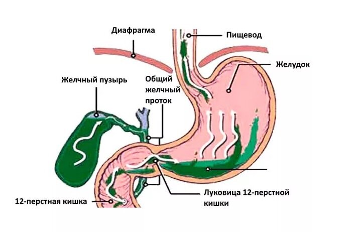 Выброс желчи во сне