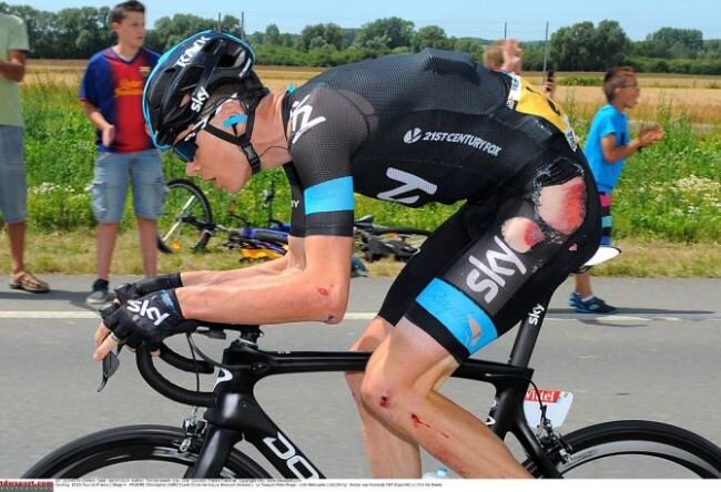 Ободранный Крисс Фрум. Фото:TDWSport.com