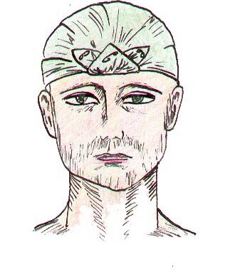        «Косынкой». При перевязке головы основание косынки кладут на область затылка, верхушка опускается на лицо, концы завязывают на середине лба, а верхушку загибают через завязанные концы на темя и там закрепляют булавкой или пришивают.   