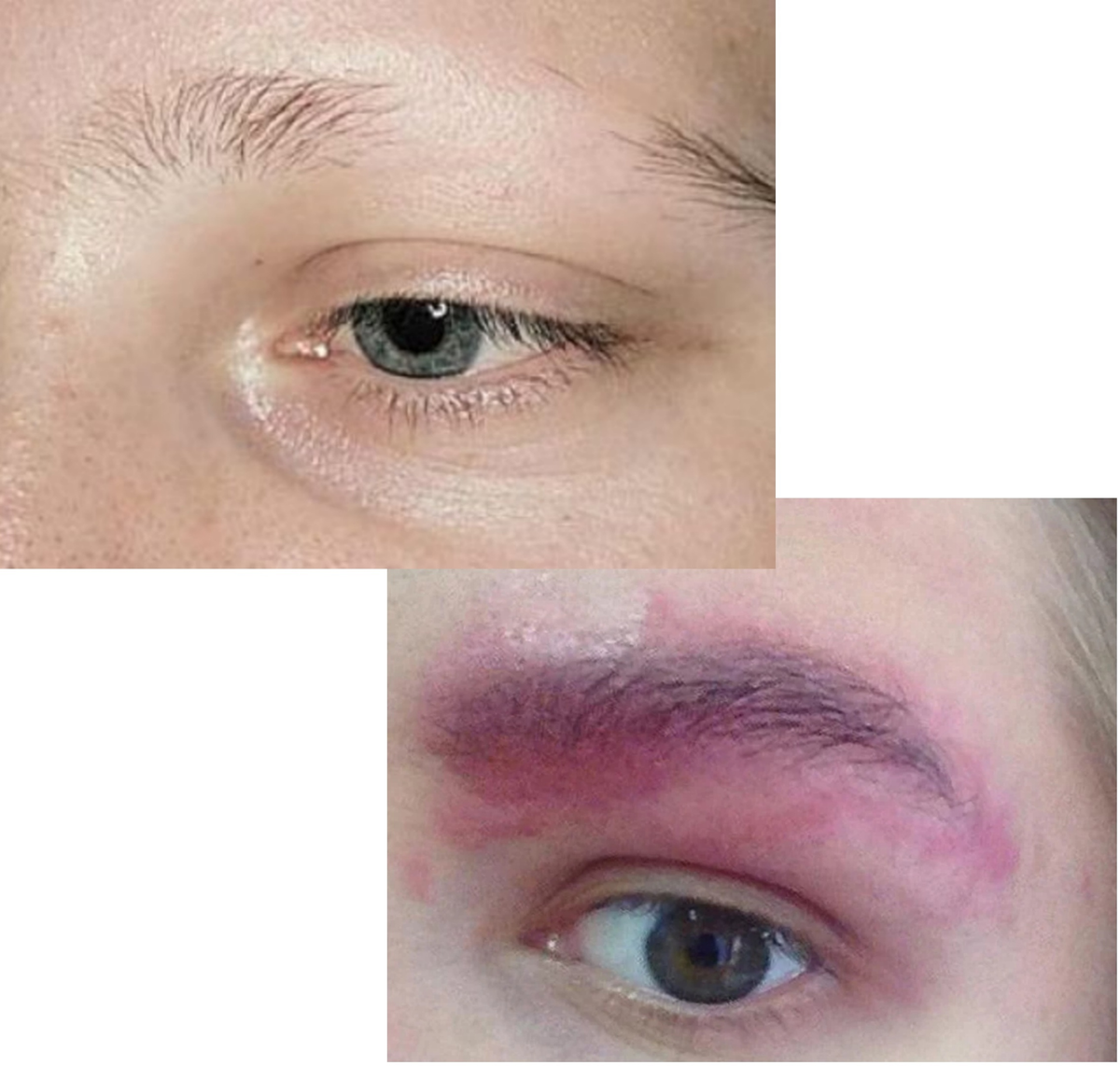 Последствия  очень частым окрашиванием бровей краской
Источник: Яндекс.Картинки