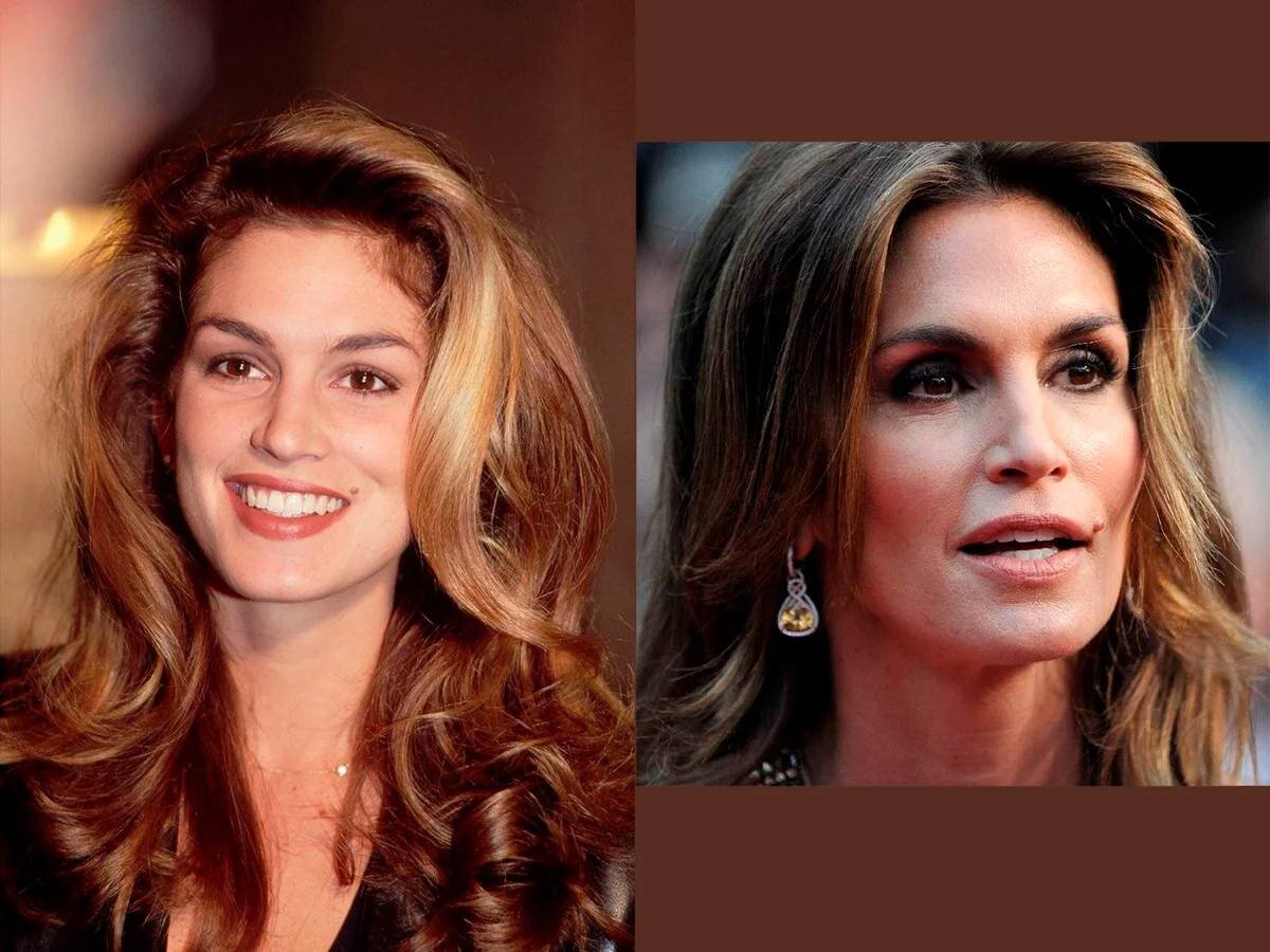 Катрин денёв тип старения. Ким бейсингер и клаудия шиффер. Катрин денёв тип старения. Мелкоморщинистый и деформационный тип старения. Мелкоморщинистый плисецкая старения.