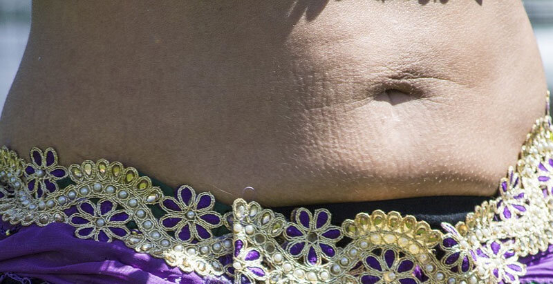 Дряблый живот