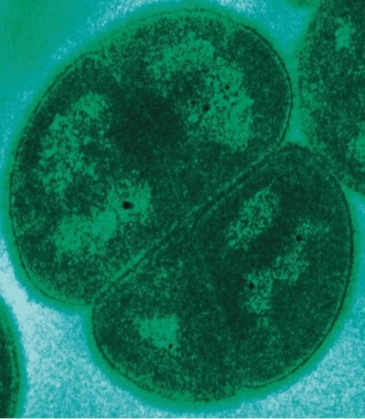 Deinococcus radiodurans - (лат.) "Ужасная ягода"