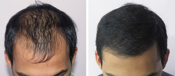 время 1 месяц