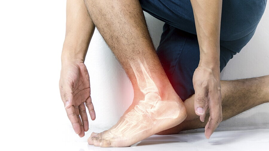 Нужна ли вам замена голеностопного сустава (артропластика)?