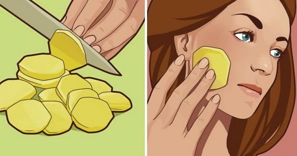 
 Неправильное питание, употребление недостаточного количества воды, вредные привычки – все это оставляет свой отпечаток на коже лица, что, конечно, обидно и досадно. Но есть натуральные продукты, которые отлично справляются с проблемой гиперпигментации.