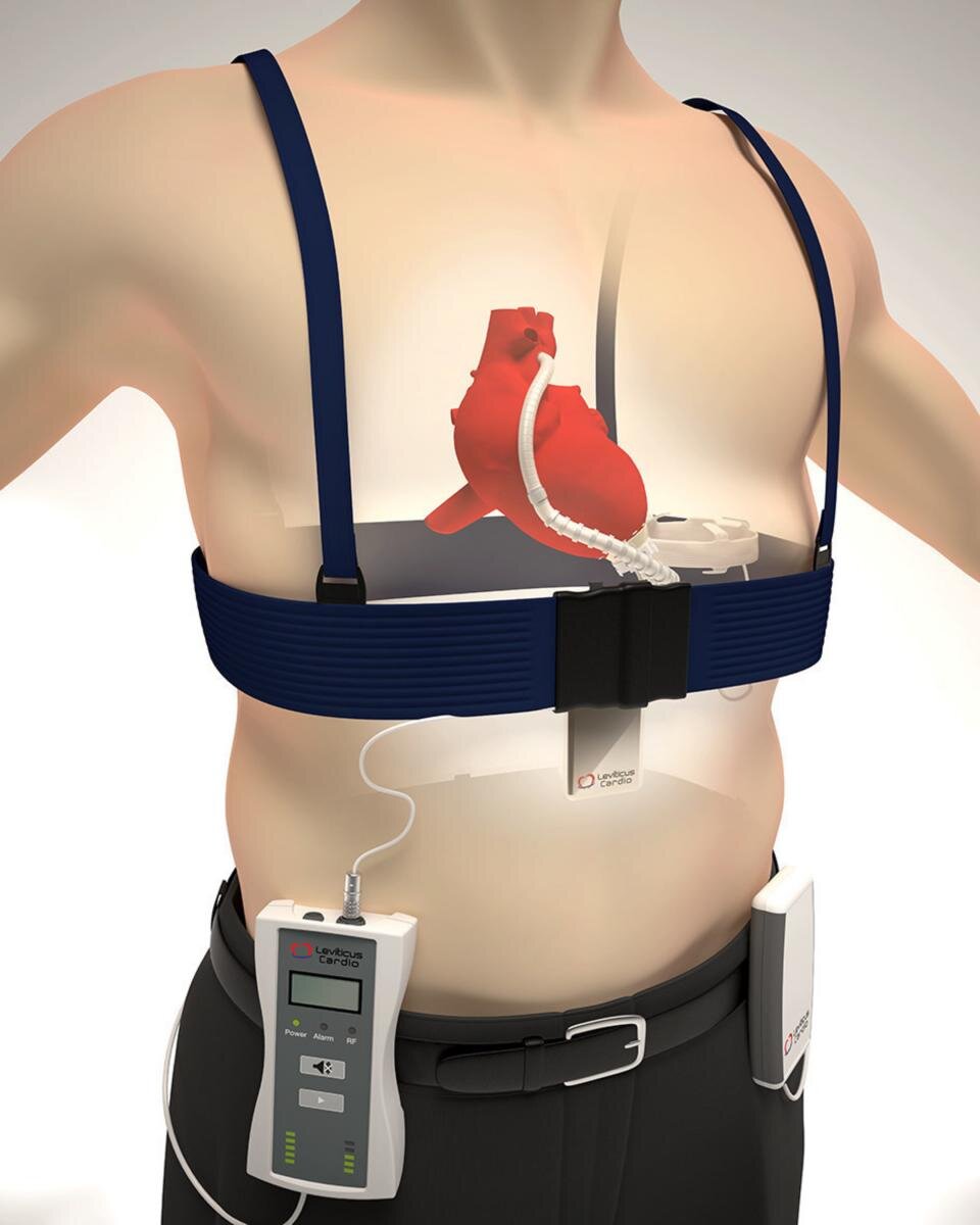 Сердечный насос с беспроводным питанием 