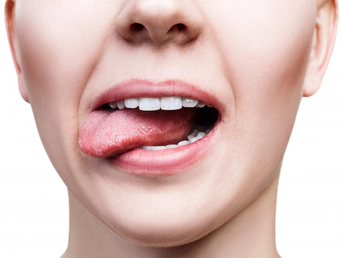 Абсцесс зуба – симптомы, причины и лечение