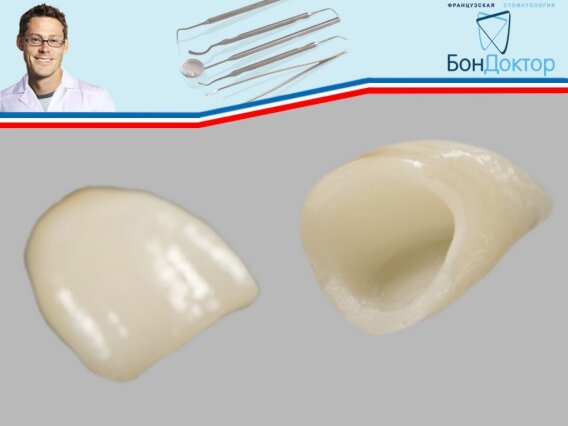 2 одиночные керамические коронки вид снаружи и изнутри!