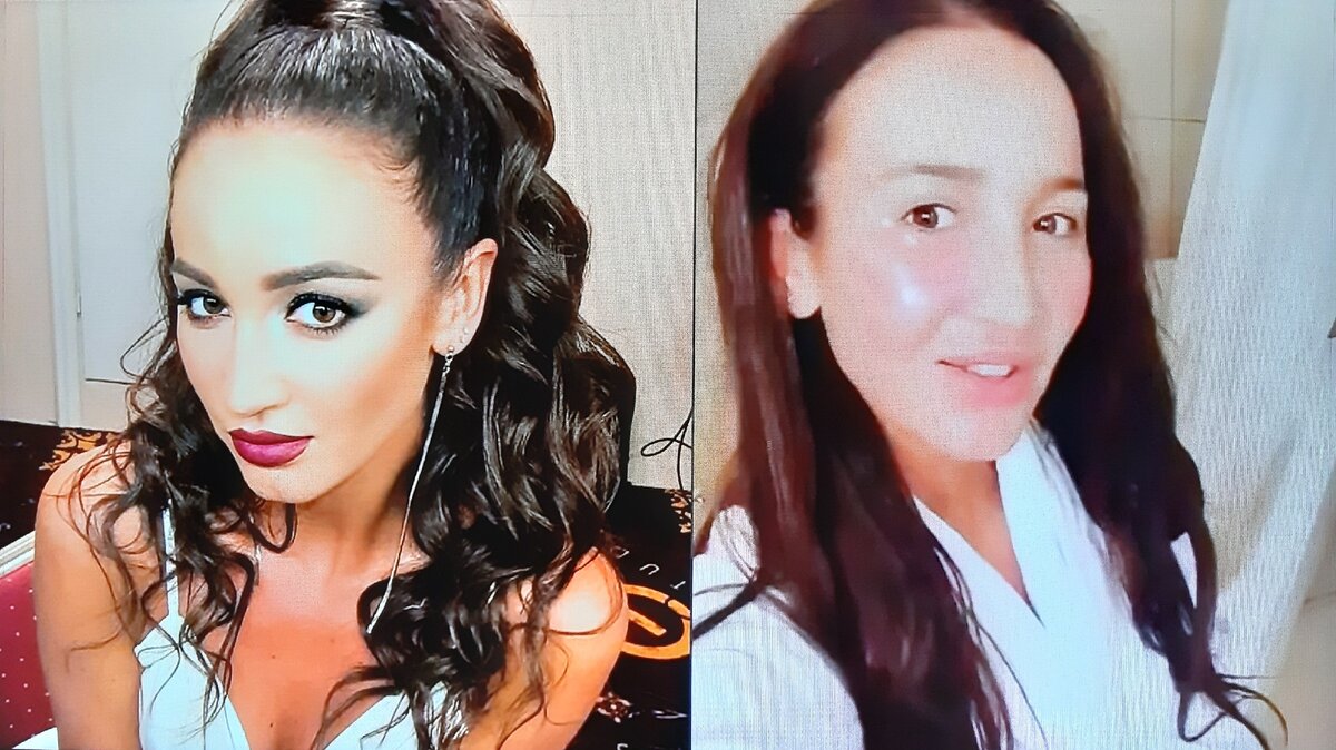 Фото бузовой до и после пластики без косметики фото
