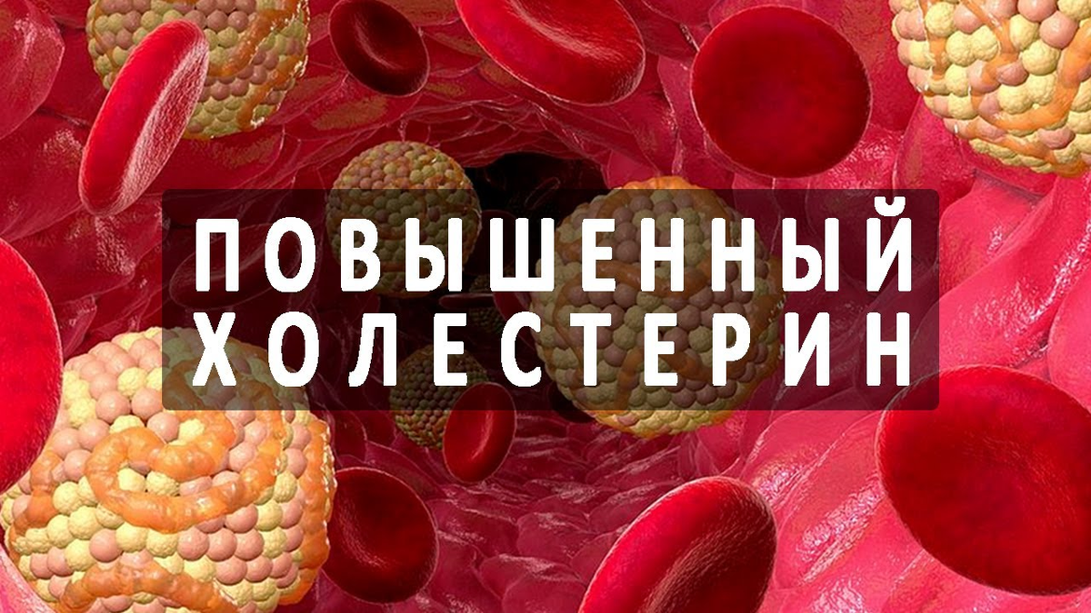 Печень повышает холестерин. Холестерин. Высокий уровень холестерина. Холестерин в крови. Высокий показатель холестерина.