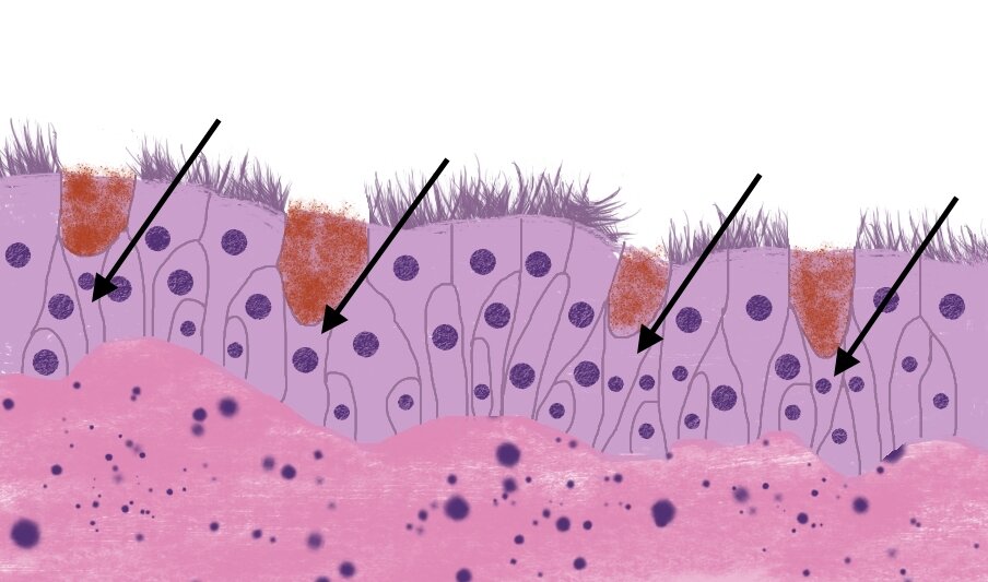 Бокаловидные клетки трахеи