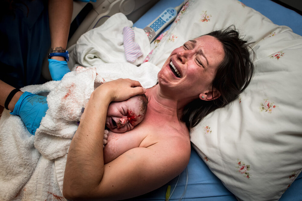 Разрывы в родах