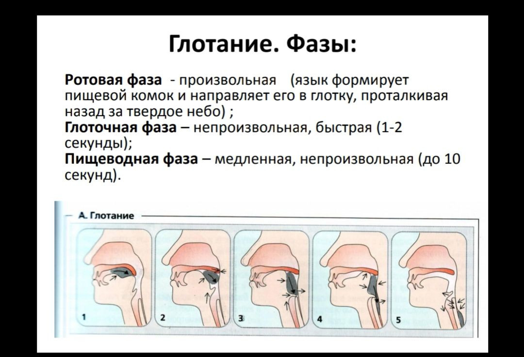 Что делать, если болит горло, и чего делать точно не стоит