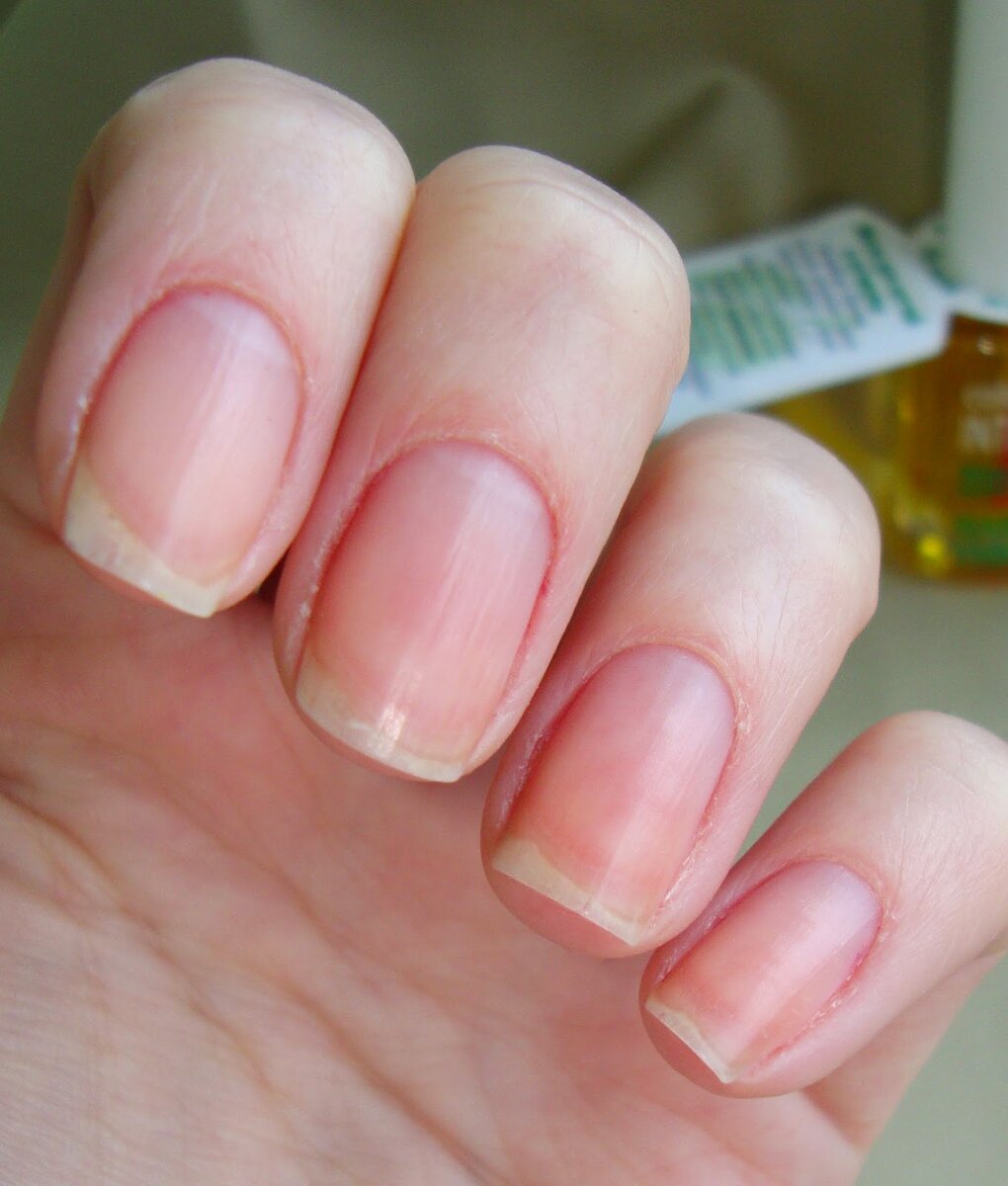 Сразу после снятия гель-лака.