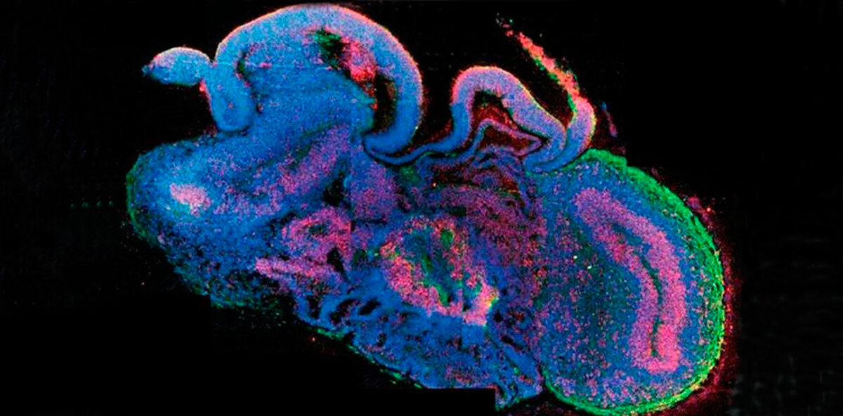 Одна из первых трехмерных структур, выращенных из стволовых клеток, – церебральный органоид. © IMBA/Madeline A. Lancaster