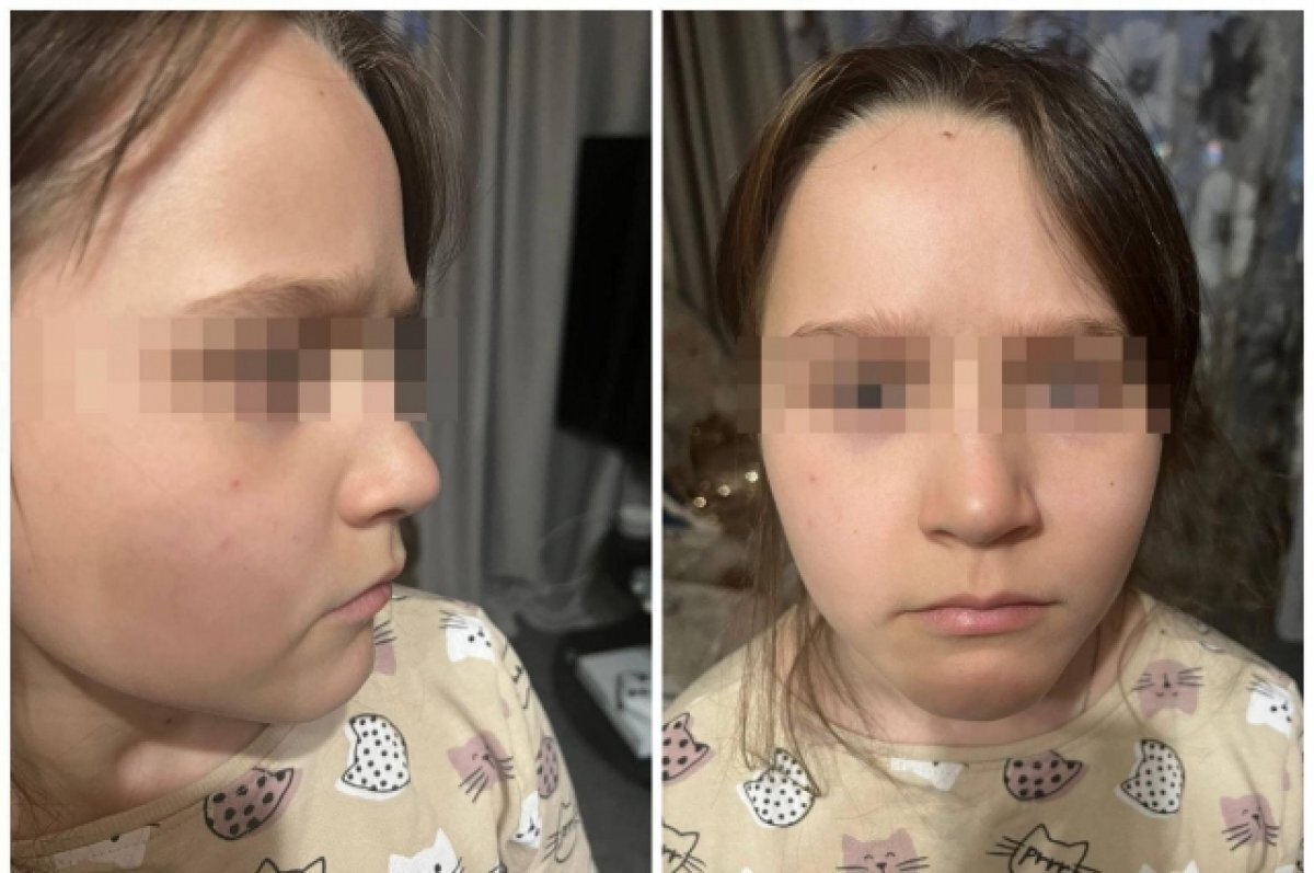    Мать пострадавшей второклассницы в Новосибирске боится за дочь