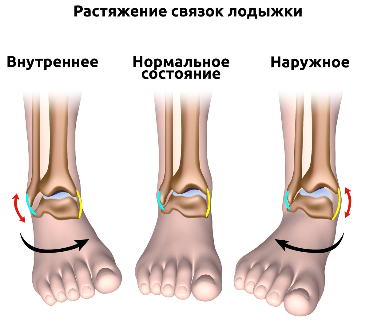 Первая помощь при ушибах и народные методы лечения