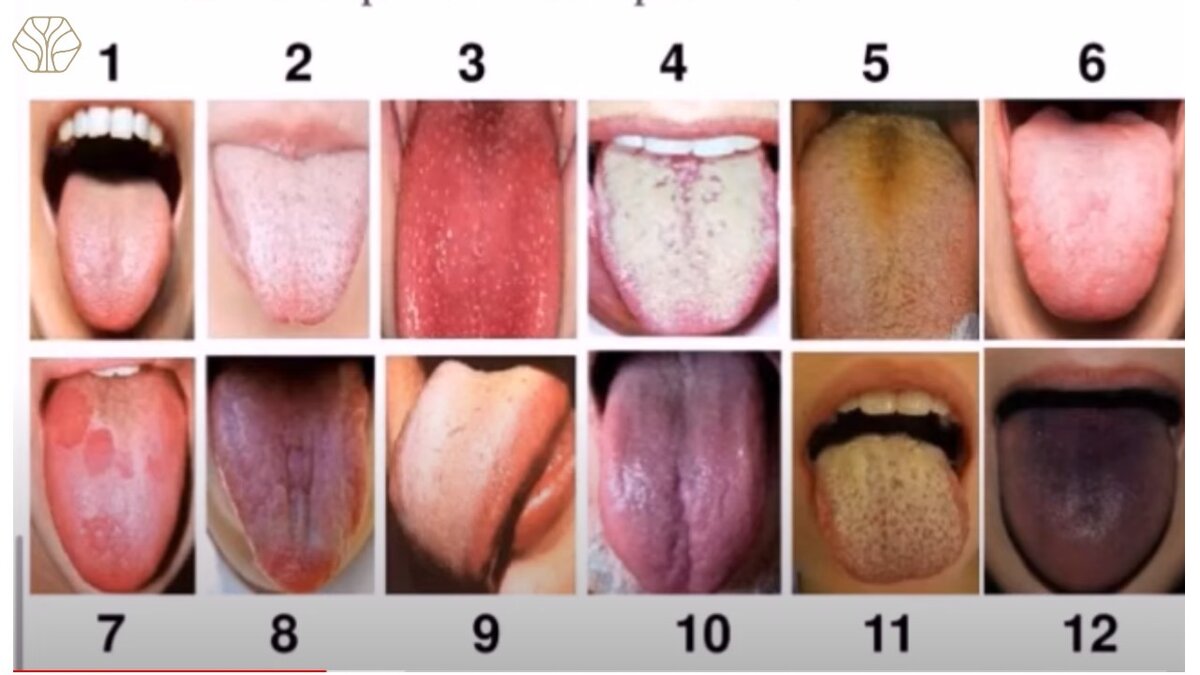 – Язык – это зеркало всего организма. Можно даже посмотреть на картинку ниже и сравнить свой язык.