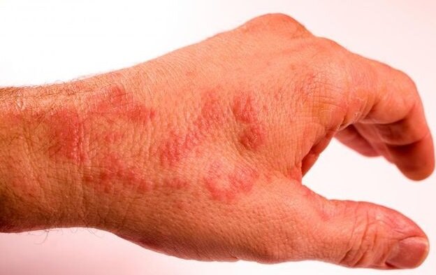 Источник картинки: snall.ru