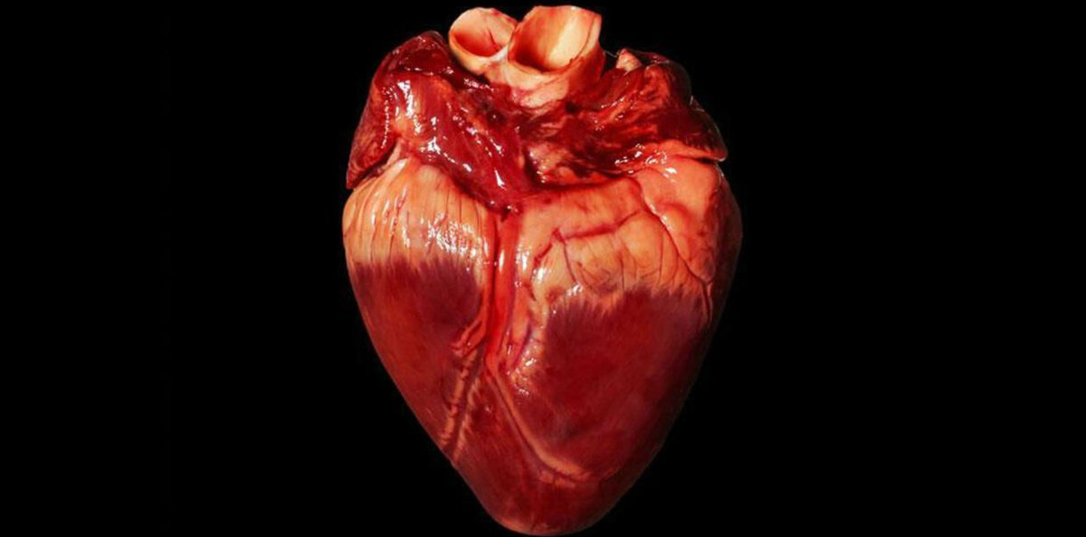 Больное сердце - sick heart