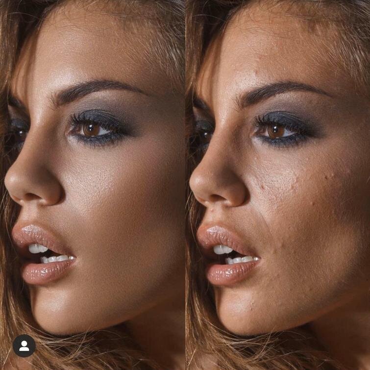 Яндекс ретушь фото до/после