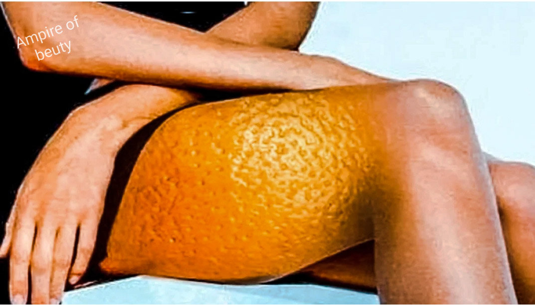 Апельсиновая корка