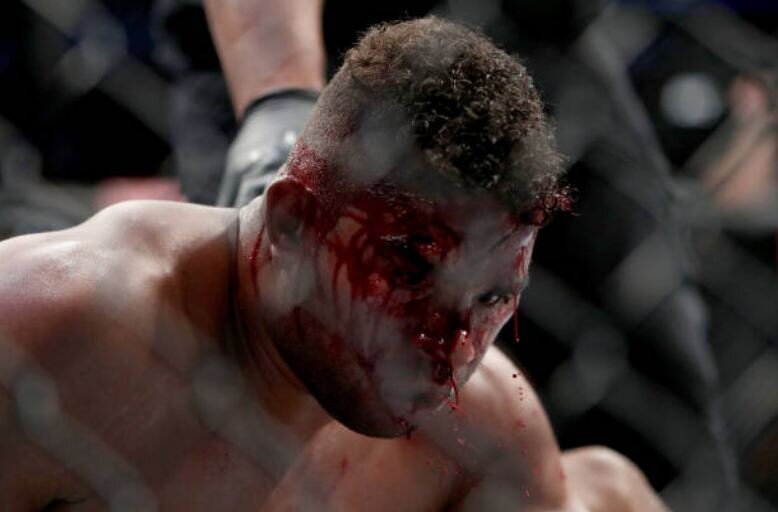 Фото: gettyimages.com