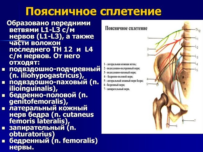 Неврит тазобедренного нерва