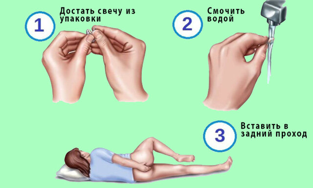 12 лучших поз для анального секса