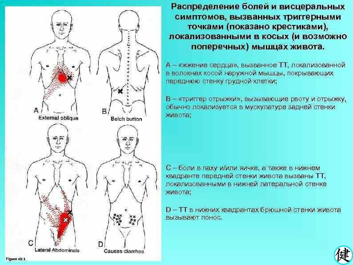 Карта боли в животе у мужчин