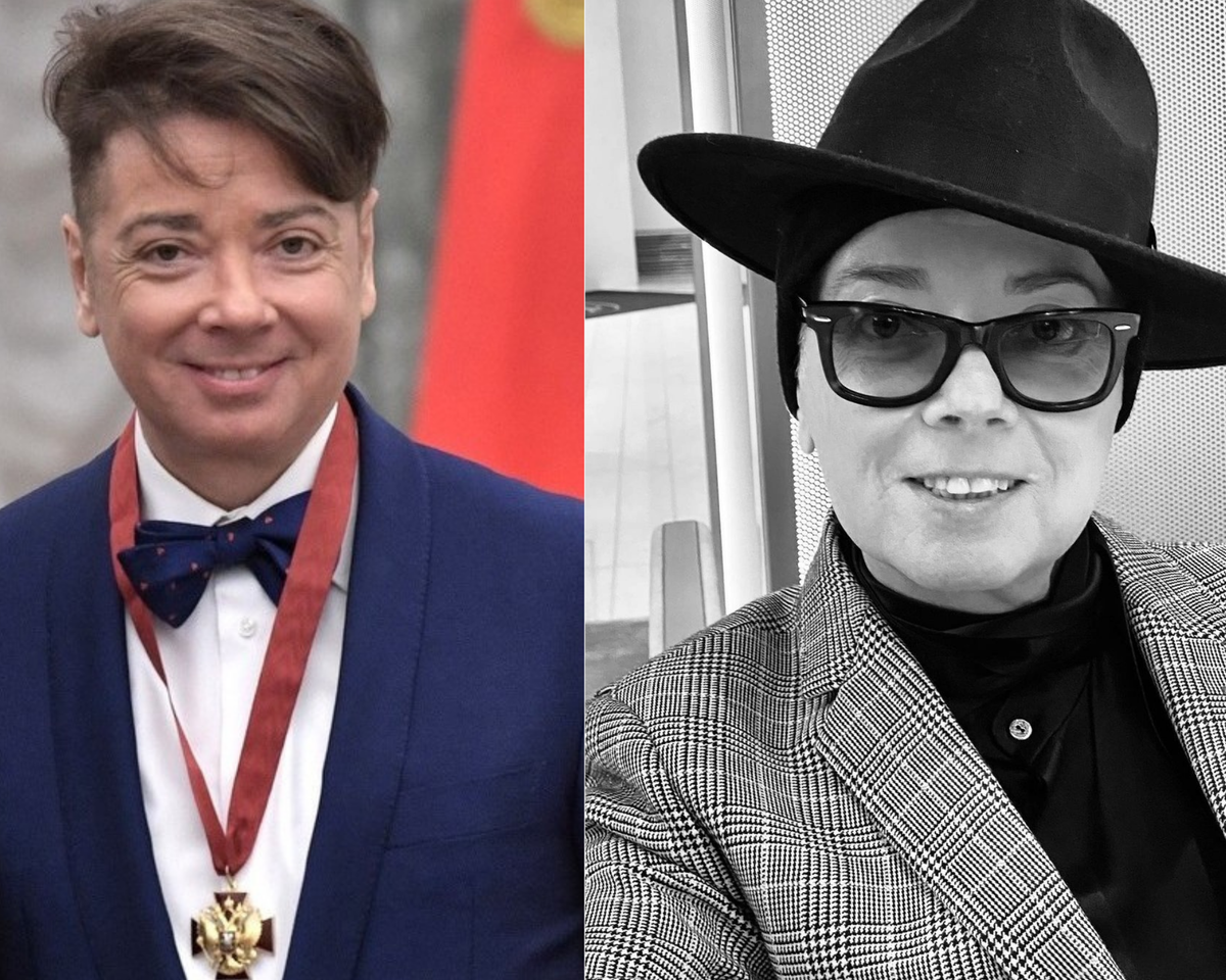 Юдашкин до (слева) и после болезни (справа). 