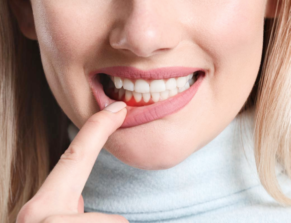 Абсцесс зуба — симптомы, причины и виды | Диагностика и лечение абсцесса десны в «СМ-Стоматология»