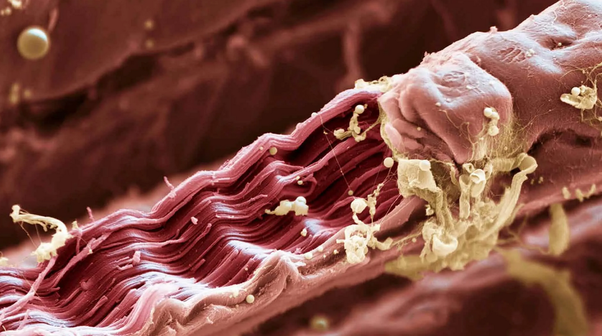 Разрыв тканей мышц. Мышечная ткань под микроскопом. Мышечные волокна под микроскопом. Мышечная клетка под микроскопом. Клетки мышц под микроскопом.